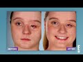 Plastic Surgeon Reacts to BOTCHED: Incredible Eye Reconstruction!