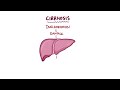 Cirrhosis - causes, symptoms, diagnosis, treatment, pathology