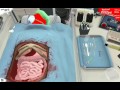 Surgeon simulator touch double kidney transplant A++ speedrun