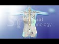 Scoliosis Right Thoracic Curve- (Boston style) Brace
