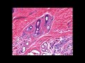 Shotgun Histology Skin Appendages