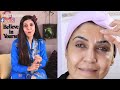 Forehead Wrinkles Treatment In 3 Minutes/Anti-Aging and Natural - Ghazal Siddique