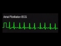 ecg samples