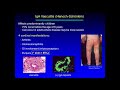 New and Emerging Treatments in Cutaneous Vasculitis