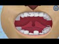 Барбоскины 👍 Игра больница 👍 Роза - доктор стоматолог 👍 Обзор игры