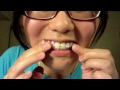 Tutorial: How to Make Fake Braces that Look Real!