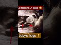 13 weeks baby in mothers womb/ Drhome/ shortvideo/ shorts