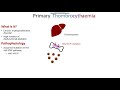 Thrombophilias - Pathophysiology, Presentation and Management