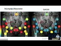 Polymyalgia Rheumatica: What has changed since 1957?