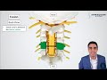 Posterior Cervical Laminectomy and Fusion - Procedure details, recovery, and expectations.