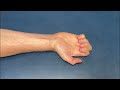 How to Relieve Carpal Tunnel Pain in SECONDS