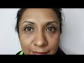 🔴 OJERAS: como ELIMINARLAS con LIPOTRANSFERENCIA 🔥 Relleno del CANAL LAGRIMAL - LIPOFILLING