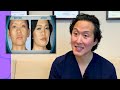 Plastic Surgeon Reacts to BOTCHED: Fillers Destroyed Her Nose!