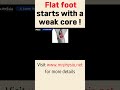 Flat feet.. tight calf.. all start from this!