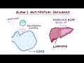 Alpha-1 Antitrypsin Deficiency - causes, symptoms, diagnosis, treatment, pathology