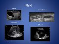 Basic principles of ultrasound