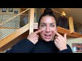 HOW I HEALED MY MELASMA/DARK SPOTS QUICKLY - REBELLE NUTRITION