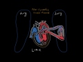 What is acyanotic heart disease? | Circulatory System and Disease | NCLEX-RN | Khan Academy