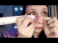 How to remove mole using mole remover pen || best product to make your skin clear #mole #skin #viral