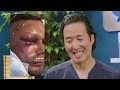 Plastic Surgeon Reacts to 5 Surgeries/1 Day Going HORRIBLY Wrong!