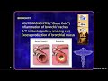Boswell CEN Review Video - Respiratory Emergencies