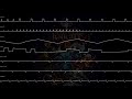 Shovel Knight OST - Strike the Earth (oscilloscope view)