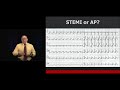 STEMI Mimics You’ve Got to Know! | The Heart Course