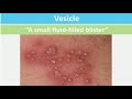 Skin Lesions with defination