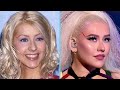 Is Christina Aguilera's Face All Natural? | Plastic Surgery Analysis