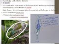 #racemose #spadix #spikelet Types of inflorescence lecture #2