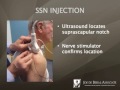 Shoulder Injections