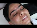 EPIC EYEBROW TRANSFORMATION 😍 CRAZY MONOBROW