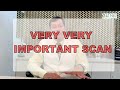 ANOMALY SCAN -Top 5 Tips | By Dr. Mukesh Gupta