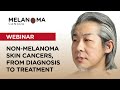 Diagnosed with Advanced cutaneous Squamous Cell Carcinoma