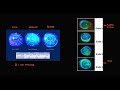 Sjogren syndrome Pathogenesis EULAR Guideline Diagnostic Criterias Treatment Explained