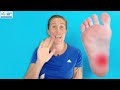 TENS for Plantar Fasciitis - Benefits and How to Use It